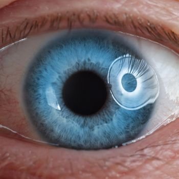 Cirurgias na Retina em Curitiba