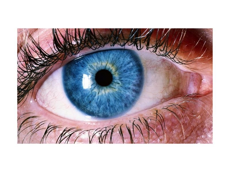 Degeneracao Macular em Curitiba