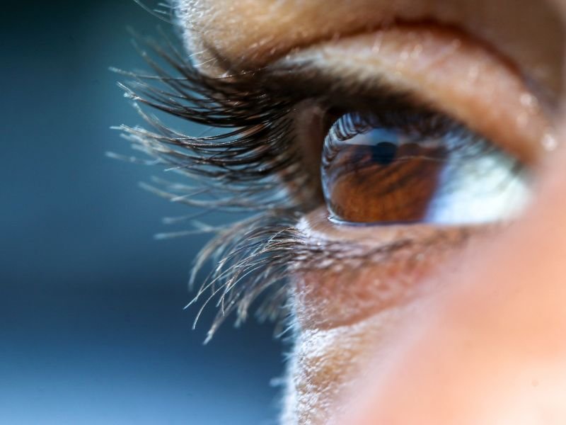 Estereo Foto de Papila em Curitiba