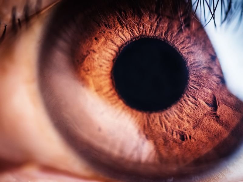 Fundoscopia em Curitiba