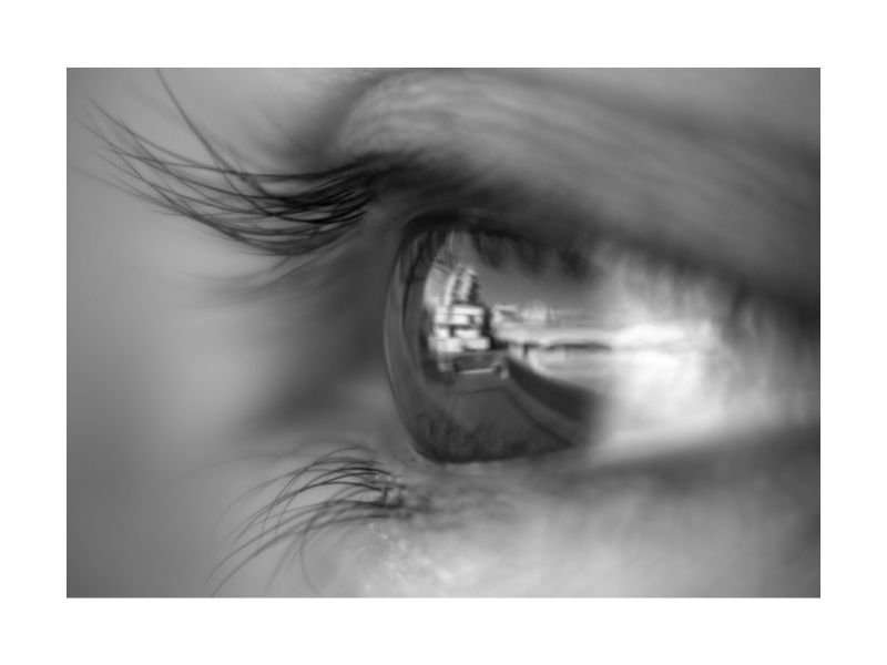 Injecao Intravitrea em Curitiba