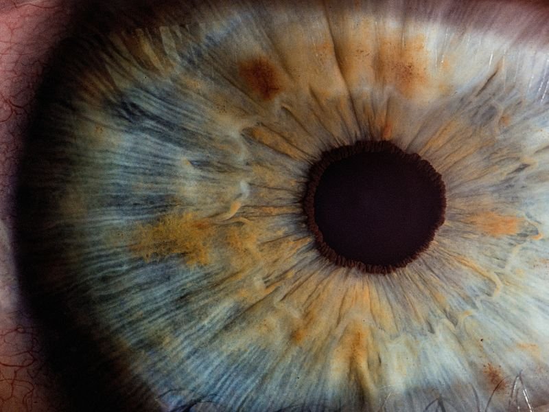 Pentacam em Curitiba