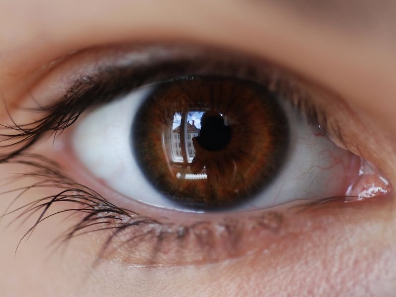 Retinopatia Diabetica em Curitiba